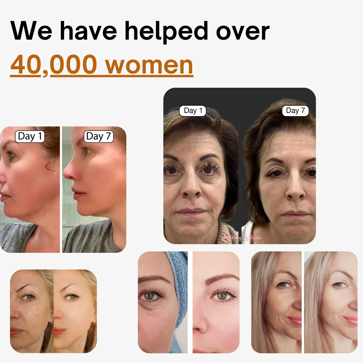 SKULPT™: Deflate Your Face. Define Your Jawline.