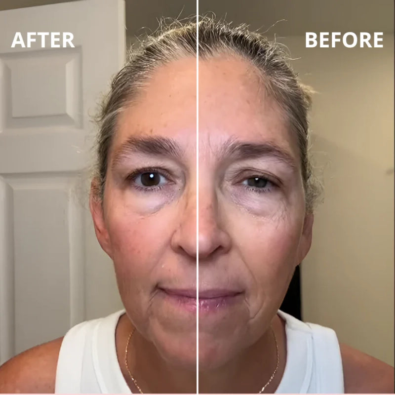 SKULPT™: Deflate Your Face. Define Your Jawline.